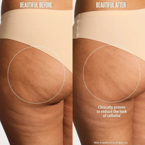 Bum_bum_cream_before_and_after